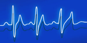 Hvad er pulstræning?