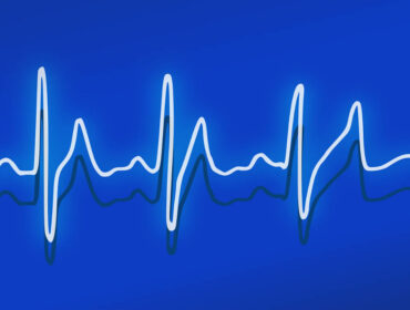 Hvad er pulstræning?